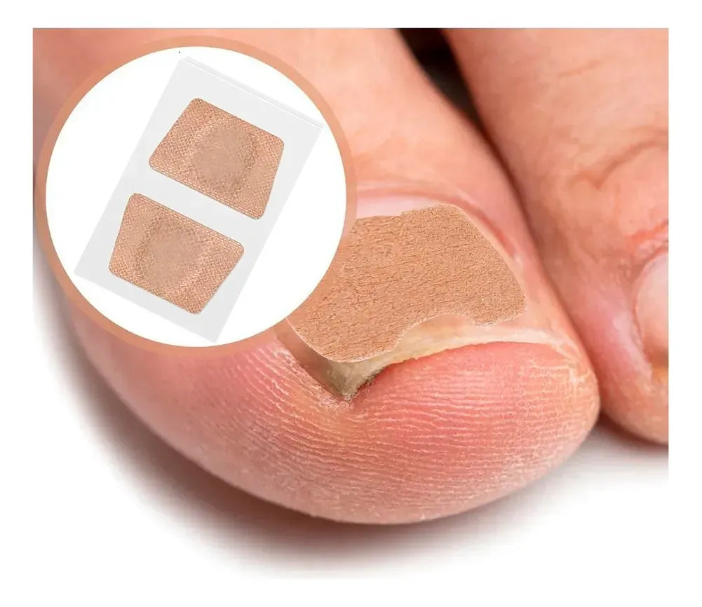 PARCHES PARA CUIDADO DE UÑAS – PACK X 32 UNIDADES
