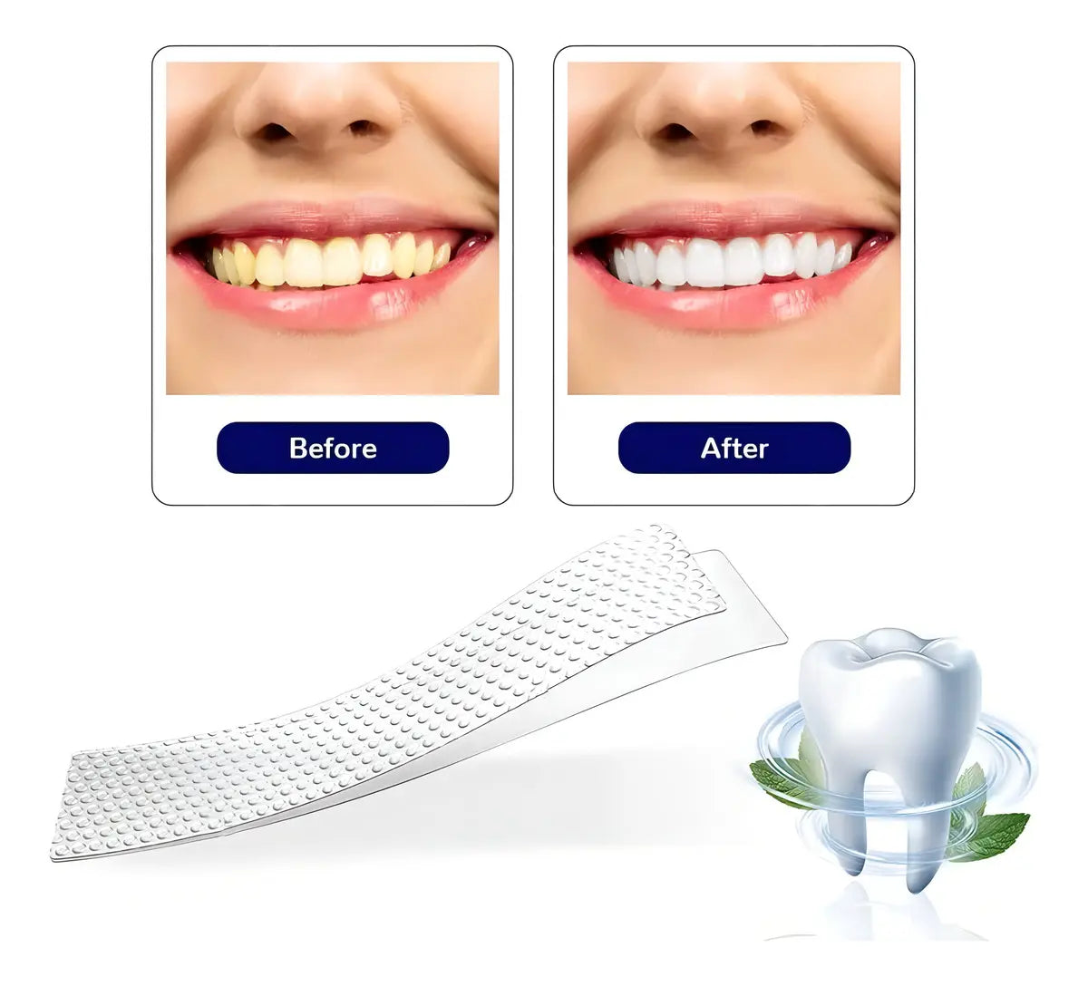 TIRAS BLANQUEADORAS DENTALES