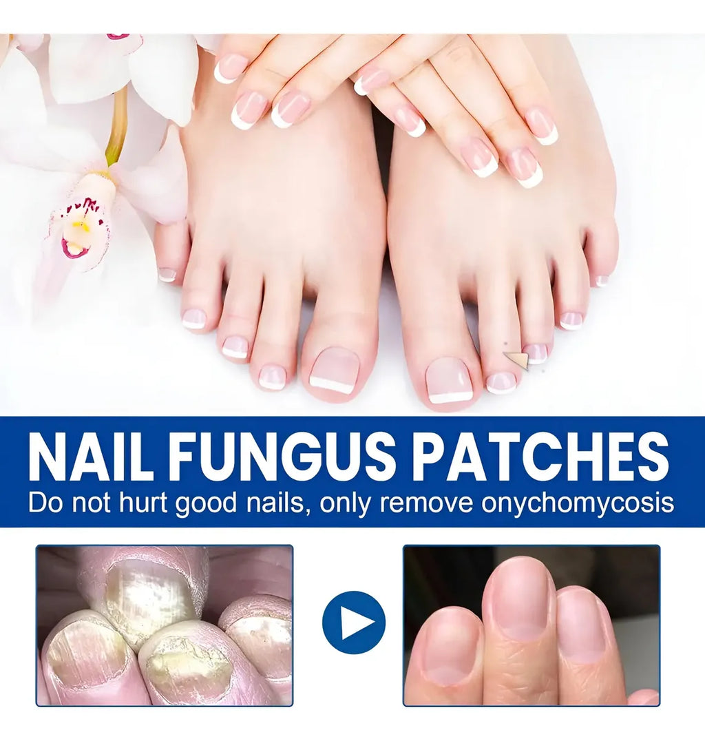 PARCHES PARA CUIDADO DE UÑAS – PACK X 32 UNIDADES