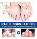 PARCHES PARA CUIDADO DE UÑAS – PACK X 32 UNIDADES